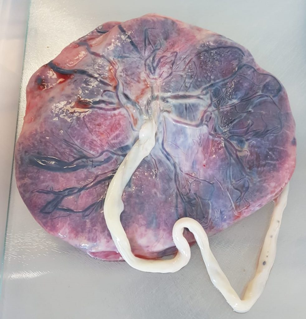 PRISM Placenta Online Module